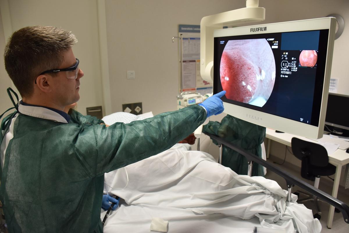 El cáncer de colon superará los 44.000 casos en España en 2026