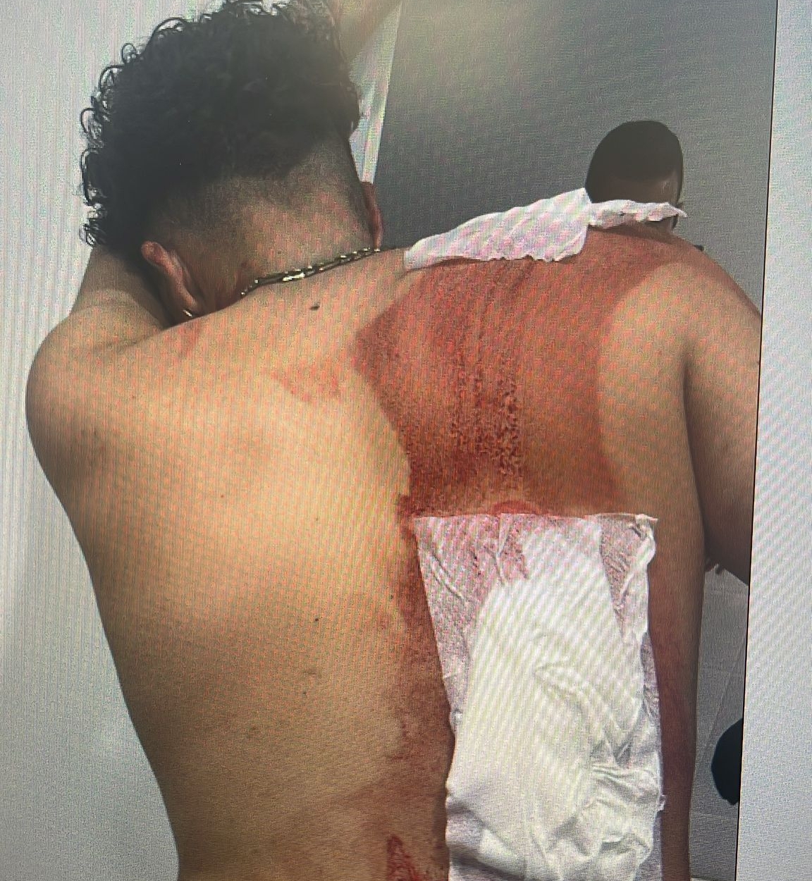 Detenido un menor por apuñalar a un joven a la salida de una discoteca en Madrid