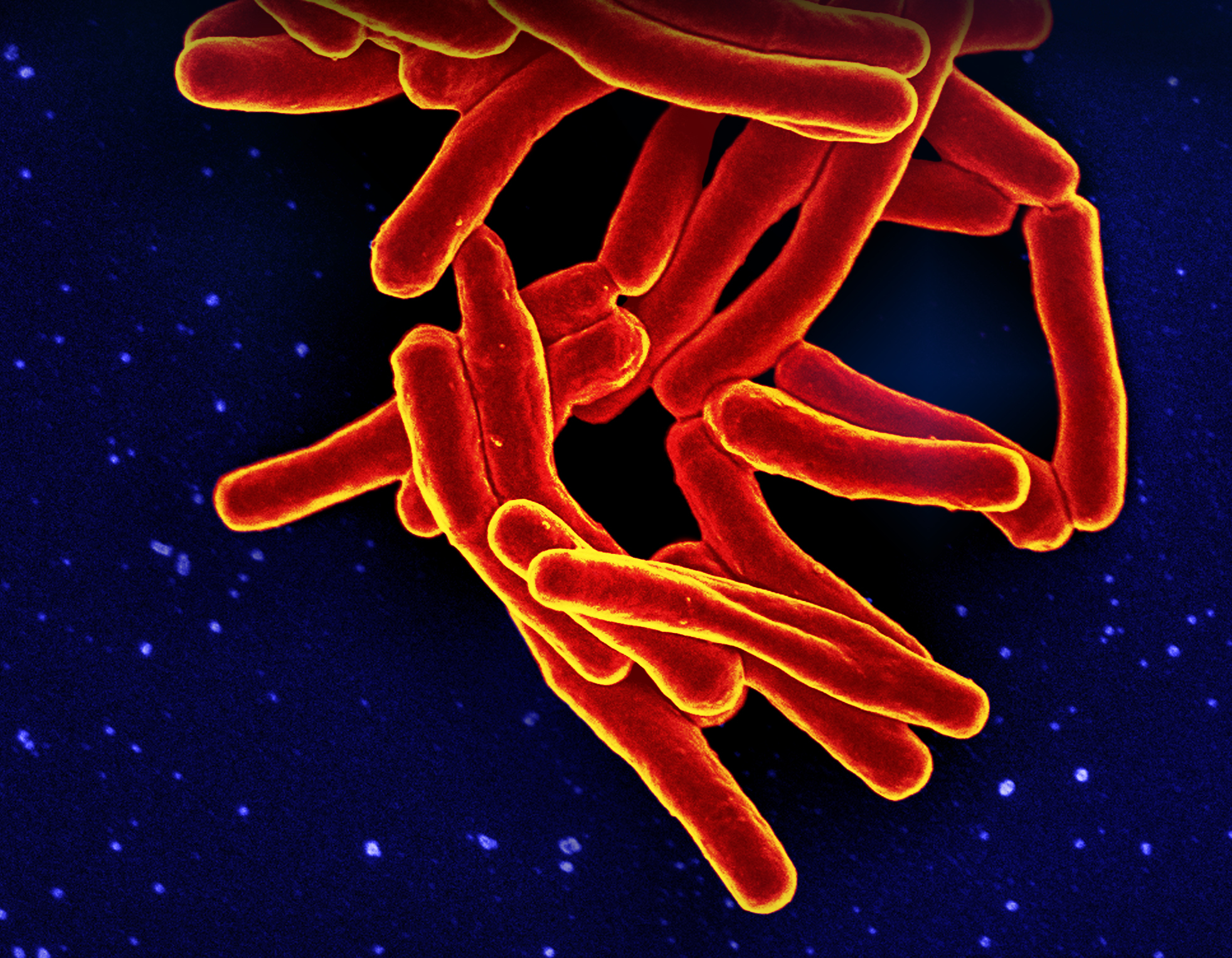 Tuberculosis en el Instituto de Medicina Legal de Toledo obliga a CSIF a pedir cierre cautelar