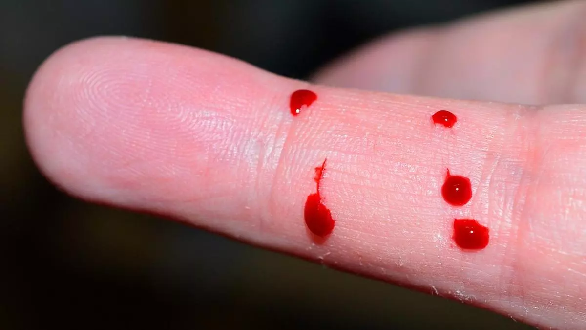 Detalle de pancartas y banderas durante la concentración