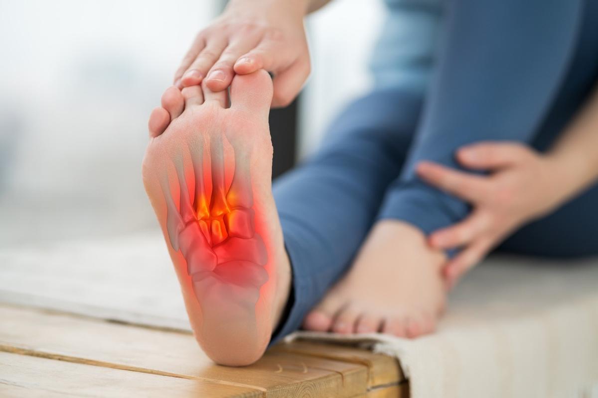 Fascitis plantar, la causa más frecuente de dolor en el talón