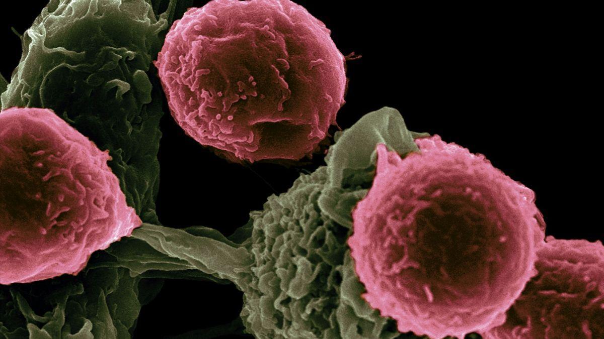 Cáncer de cuello uterino: la eliminación prevista para 2048 en países ricos