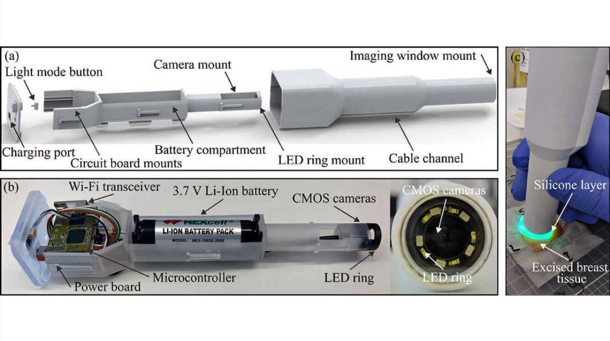 Sonda portátil detecta tumores en tiempo real durante cirugía de mama