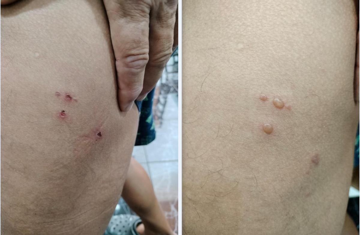 Narcopesqueros llegan a Canarias y aumentan el riesgo de hantavirus