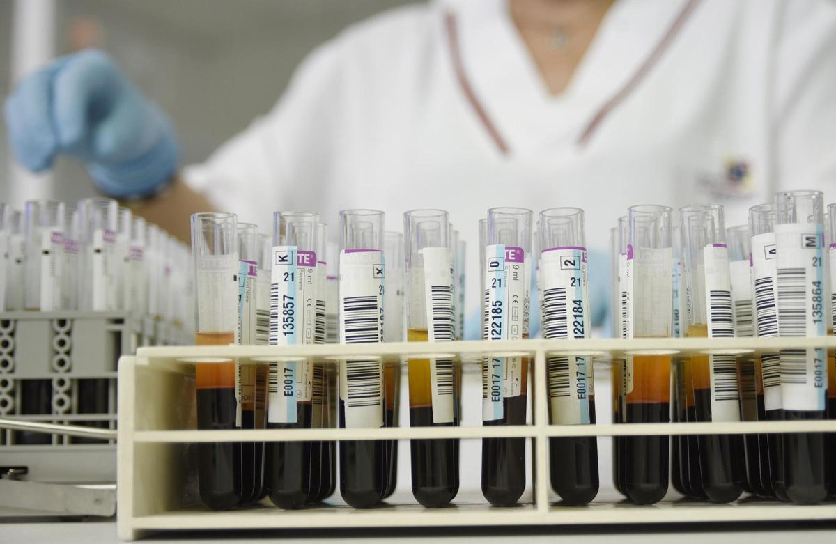 FarmaFisen de la Universidad de Alicante inicia investigación contra Alzheimer y Parkinson