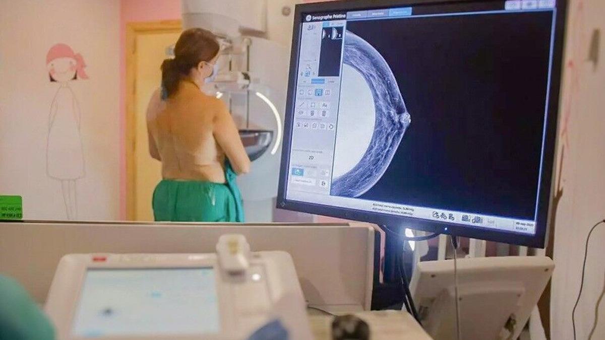 cribado cáncer mama: España amplía la mamografía a mujeres de 45‑74 años