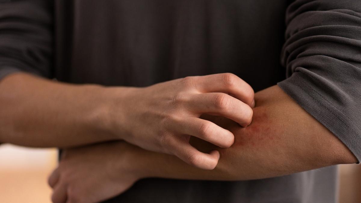 Nifurtimox disponible en España: el país lidera la lucha contra la enfermedad de Chagas