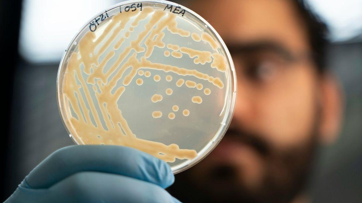 Muestra de levaduras frías extraídas de la momia de Ötzi bajo microscopio